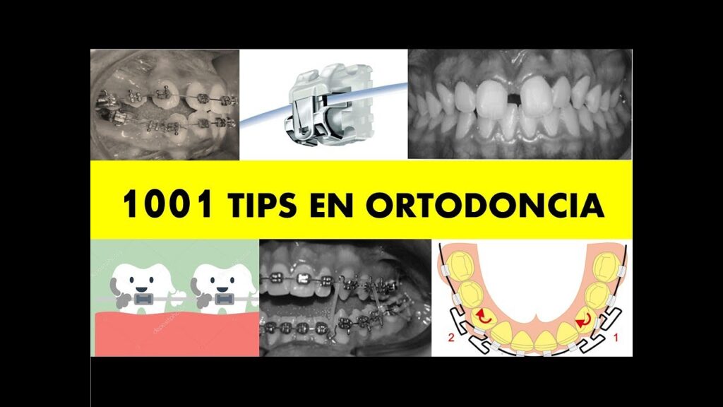 1001 tips en ortodoncia y sus secretos precio