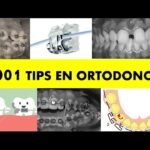 1001 tips en ortodoncia y sus secretos precio