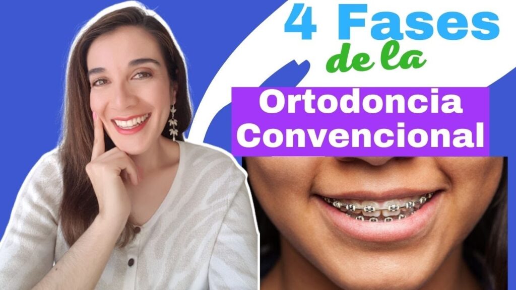 4 etapas de un tratamiento de ortodoncia