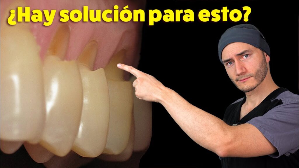 abraccion ortodoncia