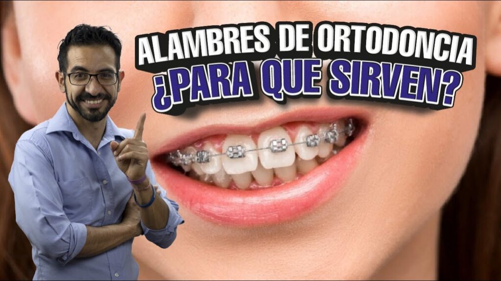 alambre australiano ortodoncia para que sirve