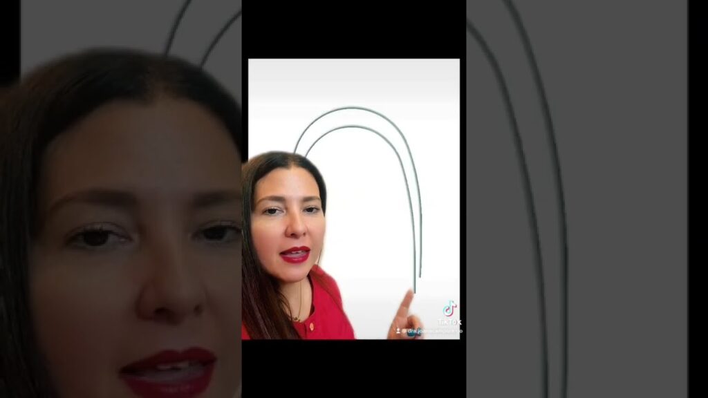 alambre de acero ortodoncia