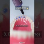 alambres ortodoncia fijacion mandibular