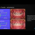 aleaciones superelasticas ortodoncias