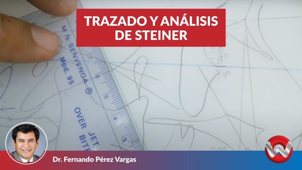 analisis de steiner ortodoncia