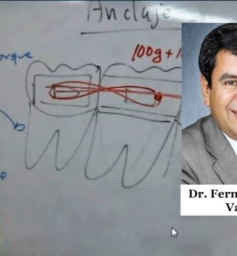 anclaje intraoral ortodoncia