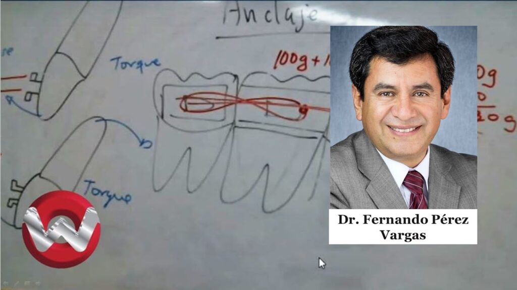 anclaje reciproco definicion ortodoncia