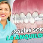 anquilosis dentoalveolar en ortodoncia