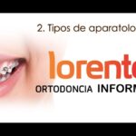 aparatologia flexible ortodoncia