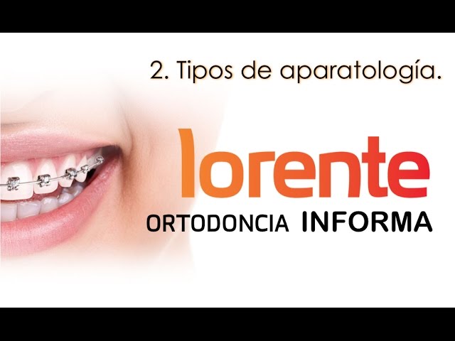 aparatologia flexible ortodoncia