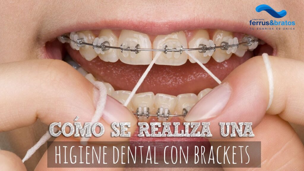 aparatos de higiene bucodental con ortodoncia