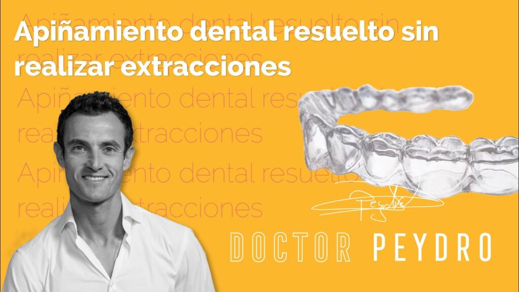 apiñamiento dental ortodoncia