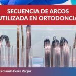 arco de ortodoncia tipos funcional