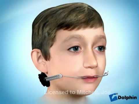 arco extraoral ortodoncia