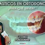 bandas de ortodoncia para ligas