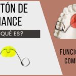 boton de nance ortodoncia