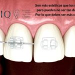 brackets madrid