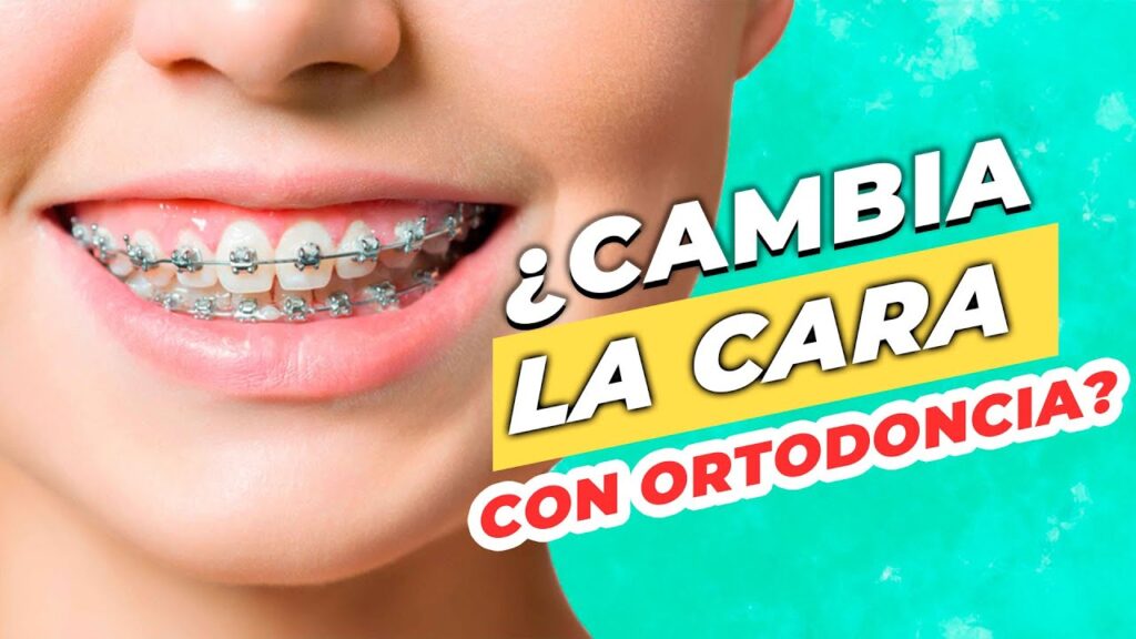 cambia el perfil con.la ortodoncia