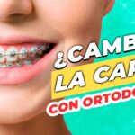 cambio de rostro por ortodoncia