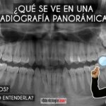 canal optico radiograficamente ortodoncia