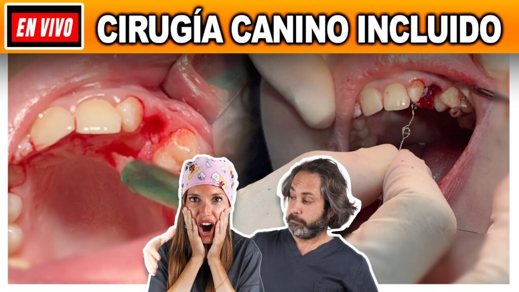 canino impactado paladar ortodoncia