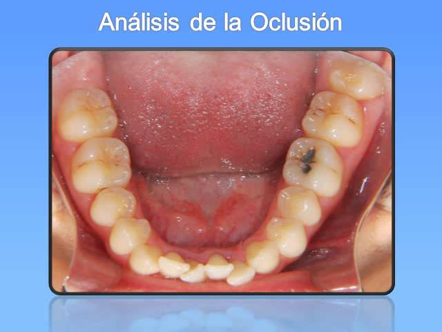 caso clinico ortodoncia
