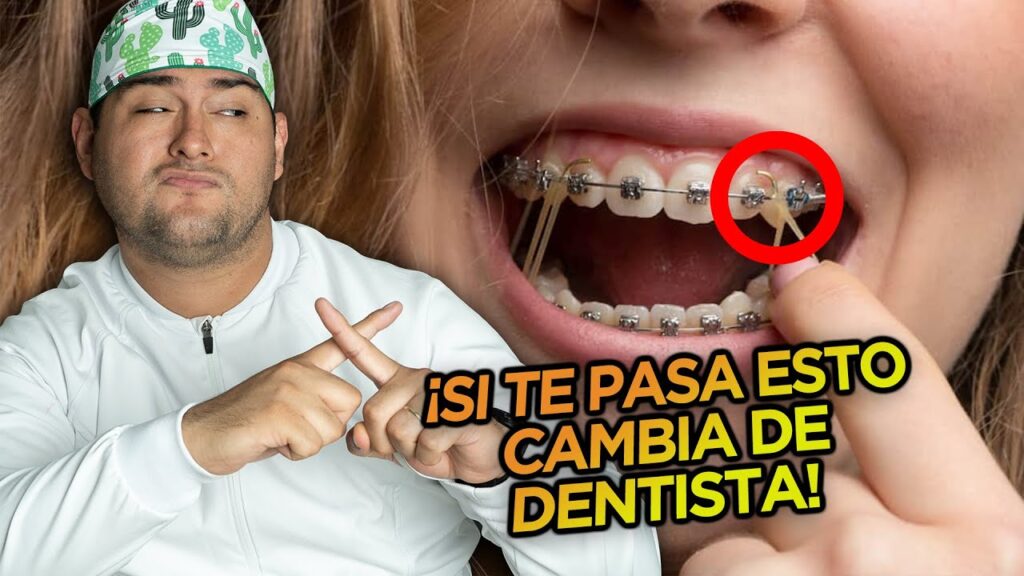 casos de ortodoncia resultado mal