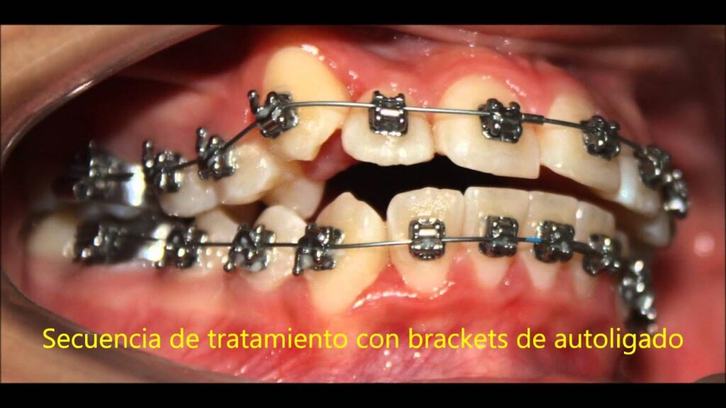 casos practicos ortodoncia