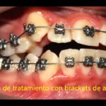 casos practicos ortodoncia