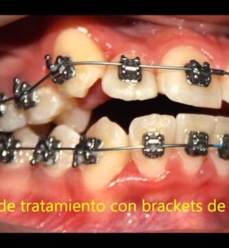 casos practicos ortodoncia