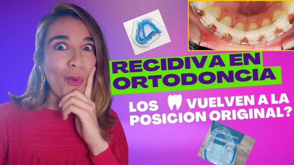 causas de recidiva en ortodoncia