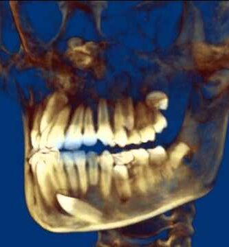 cbct ortodoncia