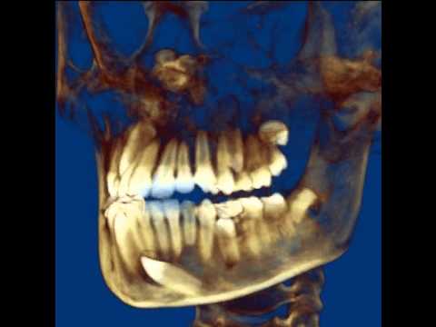 cbct ortodoncia