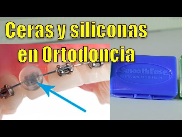 cera siliconada protectora para ortodoncia