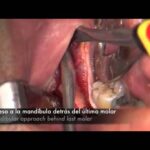 cirugia ortodoncia maxilofacial