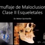 clase i esqueletal en ortodoncia