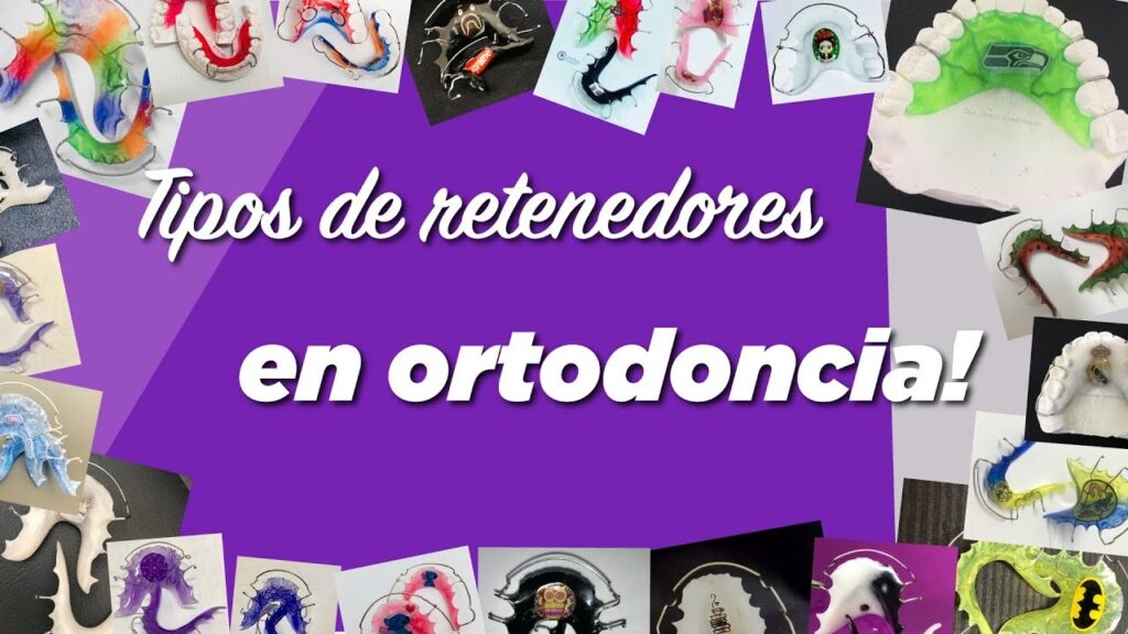 clases de retenedores ortodoncia