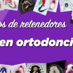 clases de retenedores ortodoncia