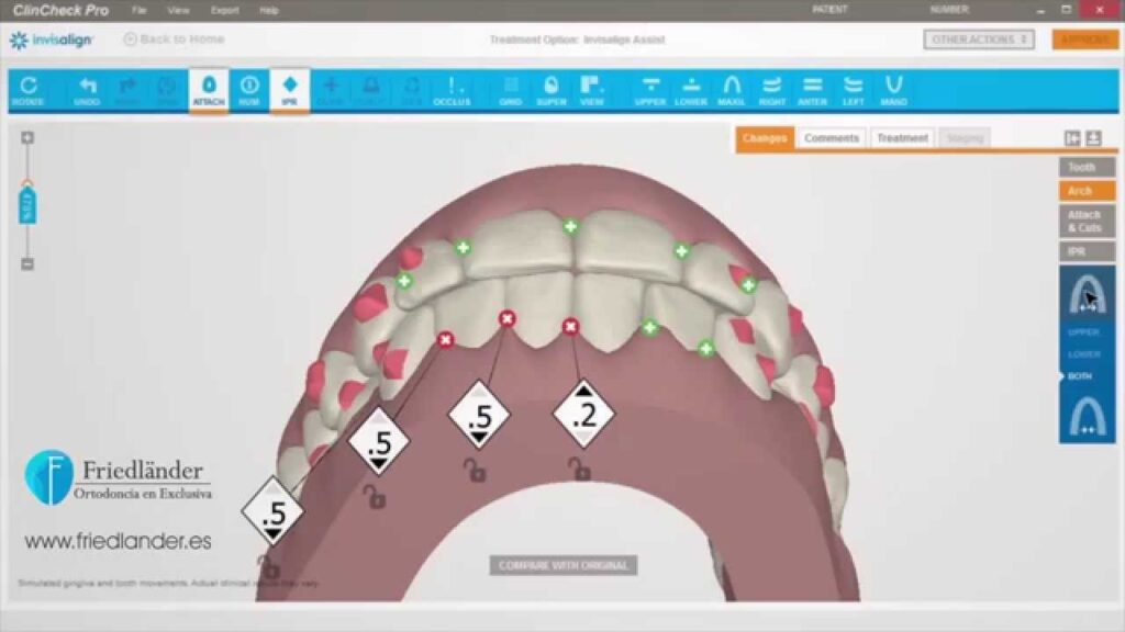 clincheck ortodoncia