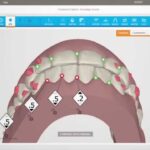 clincheck ortodoncia