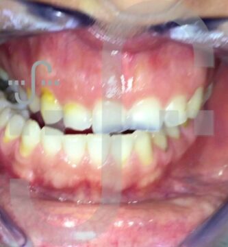 clínica de ortodoncia dr eugenio mª cordero acosta