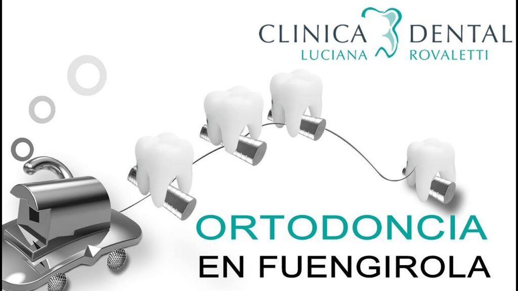 clinica de ortodoncia fuengirolaç