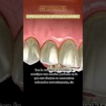 clínica dental dr ballester estética ortodoncia invisible e implantología