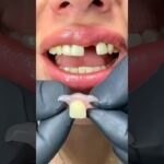 clinica dental integra miribilla