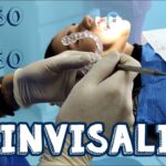 clinica dental ortodoncia invisible