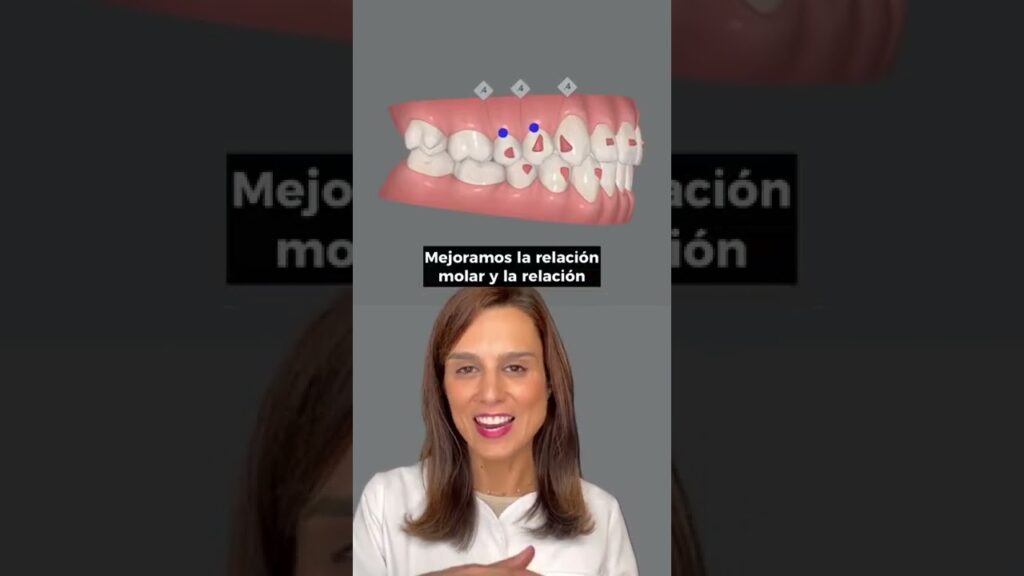 clínica dental ortodoncia maria victoria alfonso