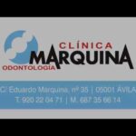 clinica ortodoncia avila