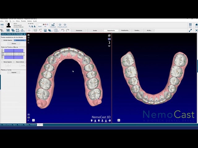 como cargar placas de ortodoncia sobre modelos 3d