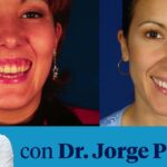 como corregir la sonrisa gingival con ortodoncia