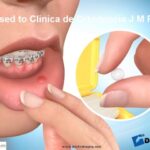 como funciona el para labios ortodoncia